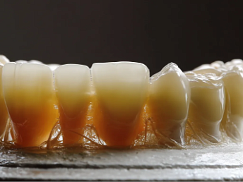 Британские ученые впервые смогли вырастить человеческие зубы в лабораторных условиях