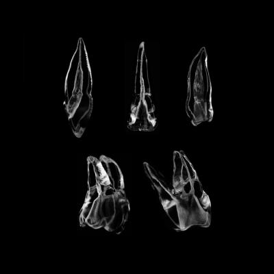 SET4 - набор демонстрационных эндомоделей зубов №4, в комплекте E1, E2, E3, E4, E5 | ID.POPOV (Россия)