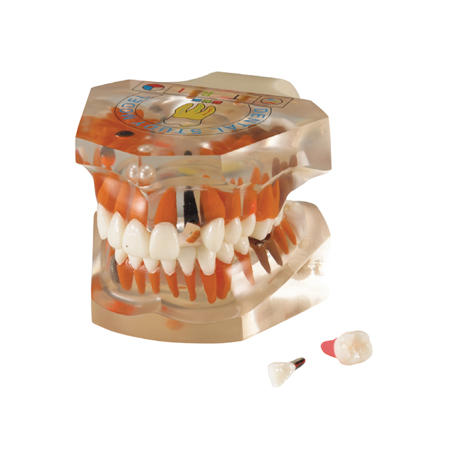 TOOTH MODEL P-TYPE - прозрачная демонстрационная модель челюсти | Hanil (Ю. Корея)