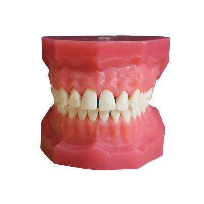 ЧВН-28У - денто-модель верхней и нижней челюстей для практики удаления зубов | Зарница (Россия)