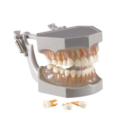 SILICON ROOT MODEL - фантомная челюсть, модель на артикуляторе со съемными зубами | Hanil (Ю. Корея)