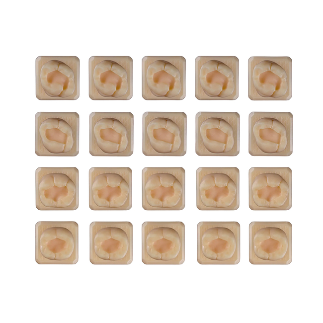 SET2 - набор демонстрационных моделей зубов №2, в комплекте 26, 27, 46, 47 | ID.POPOV (Россия)