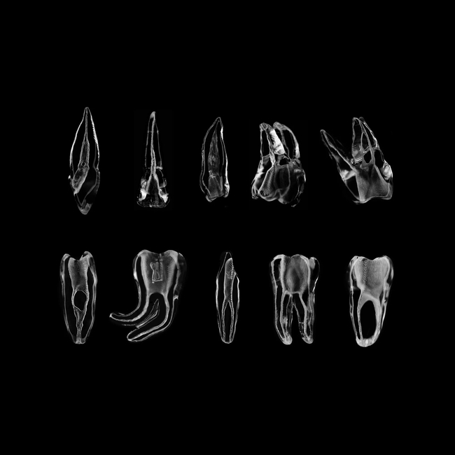 SET3 - набор демонстрационных эндомоделей зубов №3, в комплекте E1, E2, E3, E4, E5, E6, E7, E8, E9, E10 | ID.POPOV (Россия)