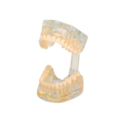 Study Model Transparent - прозрачная демонстрационная модель челюсти высокого качества | Hager & Werken (Германия)