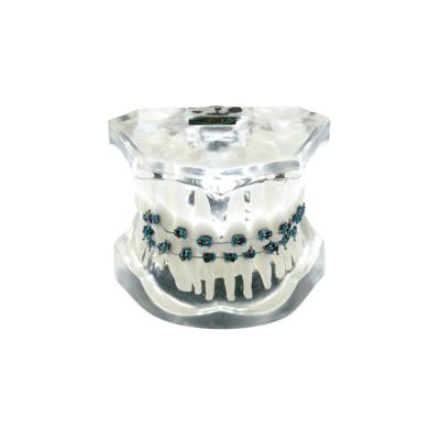 OTB5 – прозрачная ортодонтическая модель с брекетами и твердой десной | GF Dental (Италия)