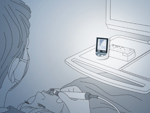 iPexII - цифровой апекслокатор