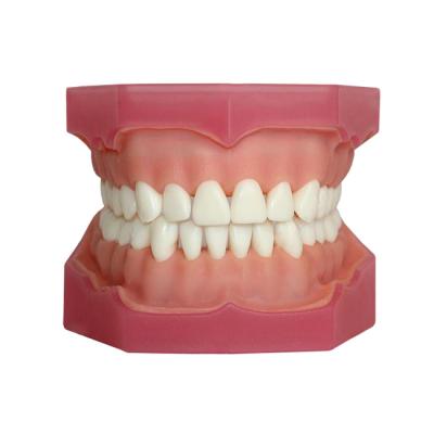 ЧВН-32А - денто-модель верхней и нижней челюстей для практики проведения анестезии | Зарница (Россия)