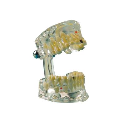 Study Model Child - прозрачная демонстрационная модель детской челюсти | Hager & Werken (Германия)