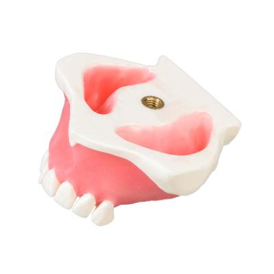 E23 – модель верхней челюсти для практики синус-лифтинга | GF Dental (Италия)