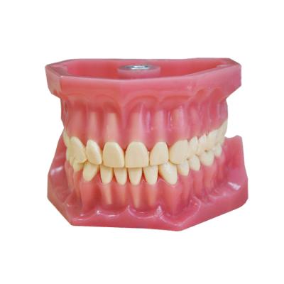 ЧВН-32 - денто-модель верхней и нижней челюсти | Зарница (Россия)