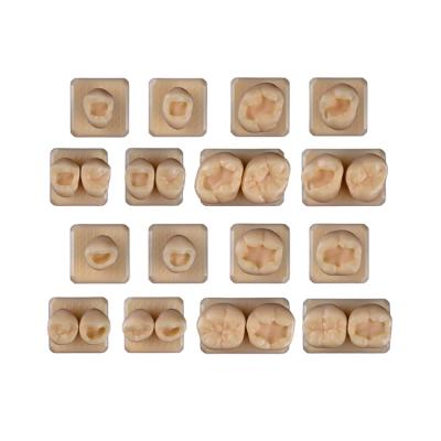 SET6 - набор демонстрационных моделей зубов №6, в комплекте 14, 15, 16, 17, 34, 35, 36, 37, S14, S15, S16, S17, S34, S35, S36, S37 | ID.POPOV (Россия)