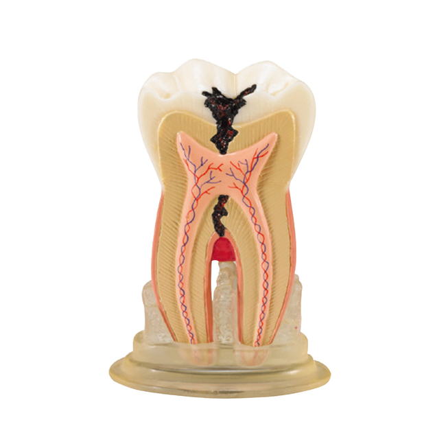 TOOTH MODEL H-TYPE - модель зуба c сагиттальным разрезом | Hanil (Ю. Корея)