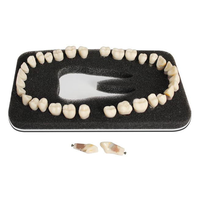 З-32П - комплект из 32 модельных зубов для денто-модели ЧВН-32П | Зарница (Россия)