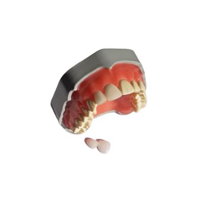 FJP-28АV – модель верхней челюсти для практики установки виниров | Medskills (Россия)