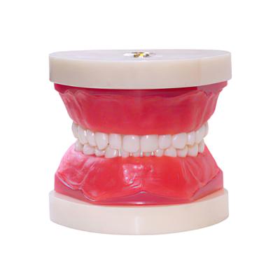 ЧВН-24 - денто-модель сменного прикуса | Зарница (Россия)